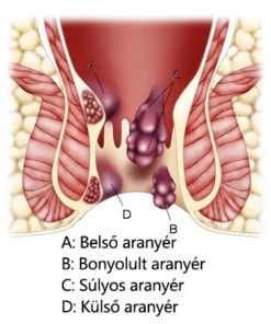 timnlik soothing comfort care spray