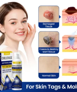 lovilds chillcare skin smoothing spray