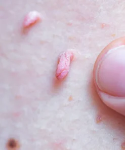 skin appearance care patch