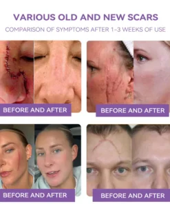 external use skin care product