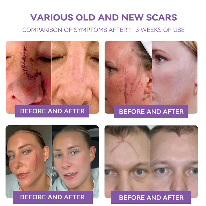 external use skin care product