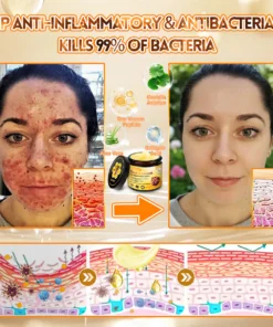 non medical skin care cream