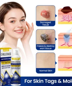 external use skin spray