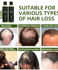 herbal hair care shampoo