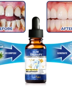 Concentrated dental treatment drops