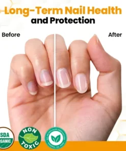 cosmetic bee venom oil