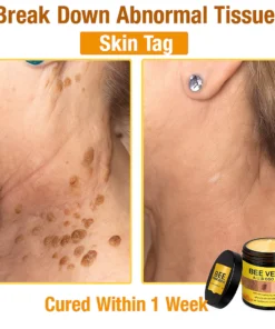 lovilds bee venom skin care cream