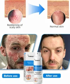 Cvreoz spray for dry skin comfort