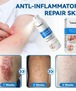 Soothing skin care spray product