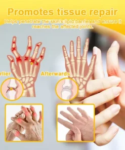 Herbal blend cream for muscle discomfort