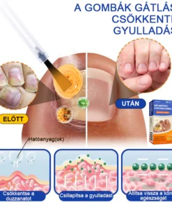 furzero bee venom nail care solution