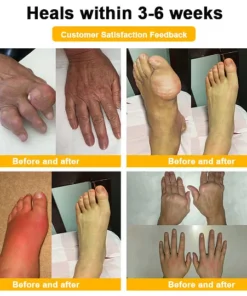 ODALIT soothing muscle cream jar