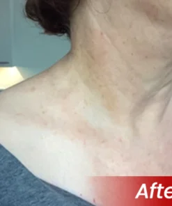 non medical skin care patch