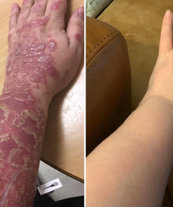 botanical soothing skin treatment