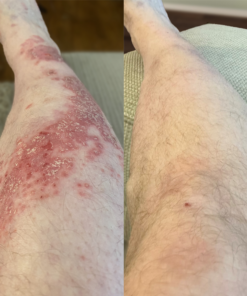 foulme intensive recovery cream