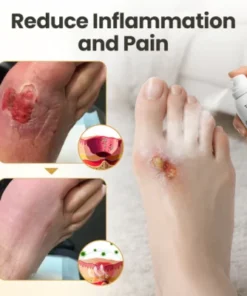 protective foot care lifestyle solution