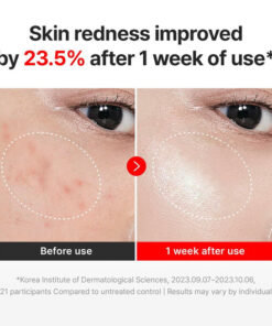 advanced hydration madeca cream