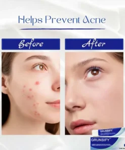 hydroglow hyaluronic acid serum