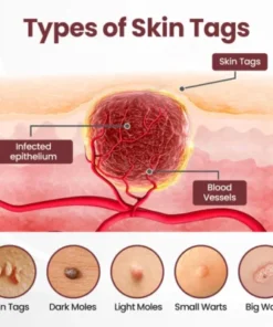 biancat soothing cream for rough skin