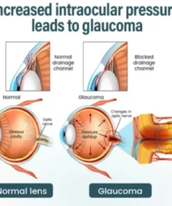 eye care lifestyle drops