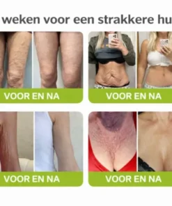 retinol infused face moisturizer