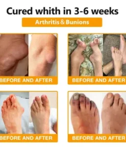 daily mobility support body gel