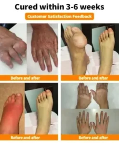 apivitalis premium botanical comfort formula