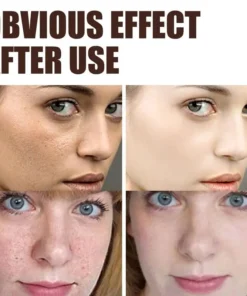 brightening eye contour treatment