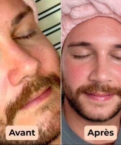 facial impurity removal serum