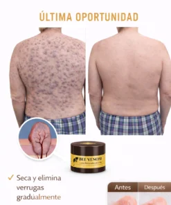 apivitalis natural skin elasticity support