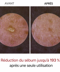 puraderm skin texture refiner