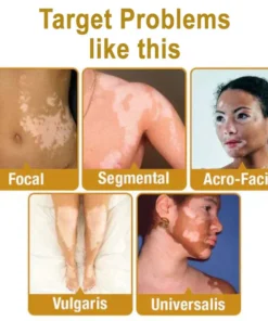 Anti-wrinkle cream with bee venom